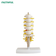 Lumbar Vertebrae with Sacrum & Coccyx and Herniated Disc XC-119 Series