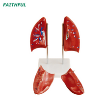 XC-321B Lung Model (1 Part)