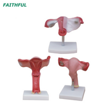 XC-436 Series Uterus Model