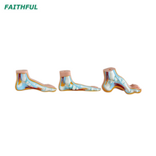  XC-326 Series Foot Anatomical Model