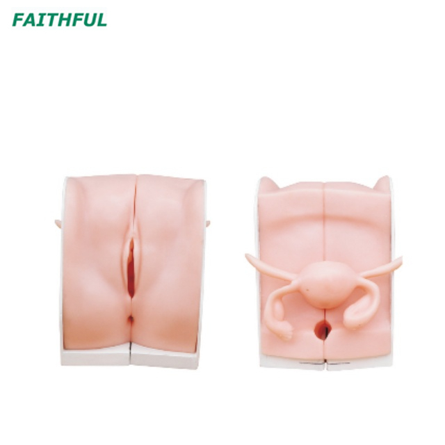 XC-417 Contraception Guidance Model