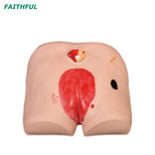 XC-459 Decubitus Ulcer Care Model