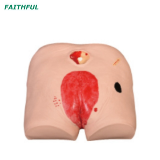 XC-459 Decubitus Ulcer Care Model