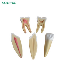 XC-305 Expansion Model of Human Teeth